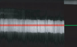 Ring-counting image showing closely spaced ring edges and reference lines